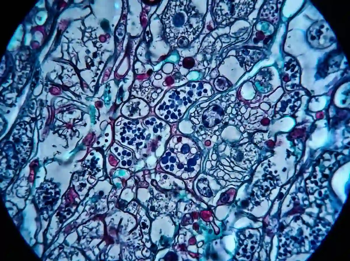 Specialist Course in Parasitology