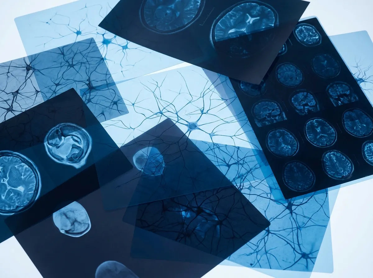 Curso Superior en TEA: Especialización en Diagnóstico y Tratamiento del Trastorno del Espectro Autista